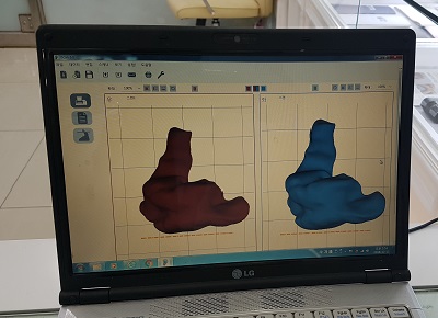귀 3D 스캔 데이터 — 좌우 외이도 형상